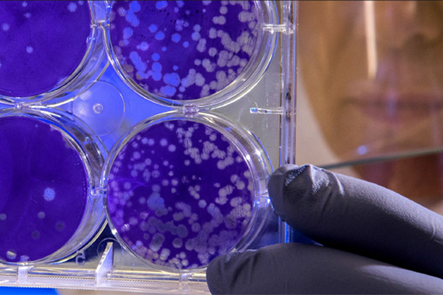Cancer Stem Cells as the Key to Cancer